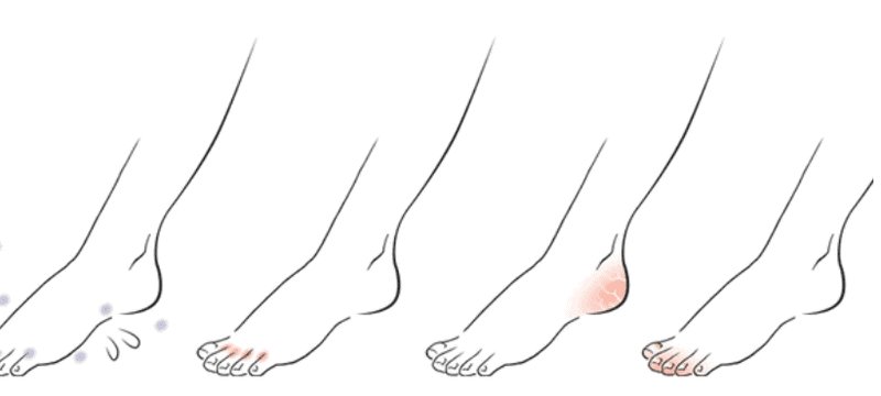 Guide to exodermin apteka gemini Guide to exodermin apteka gemini